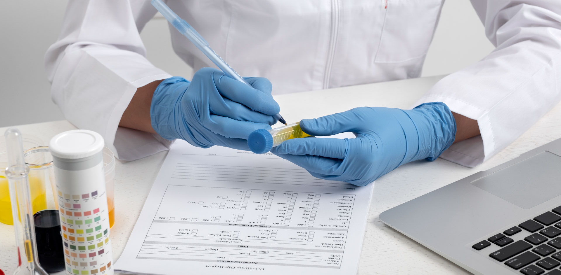 Analysis of food samples for pesticides