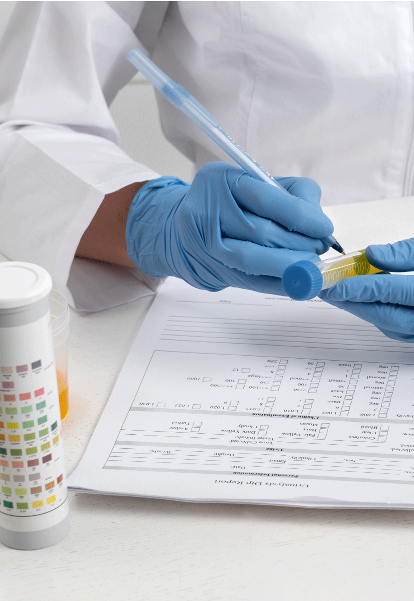 Analysis of food samples for pesticides